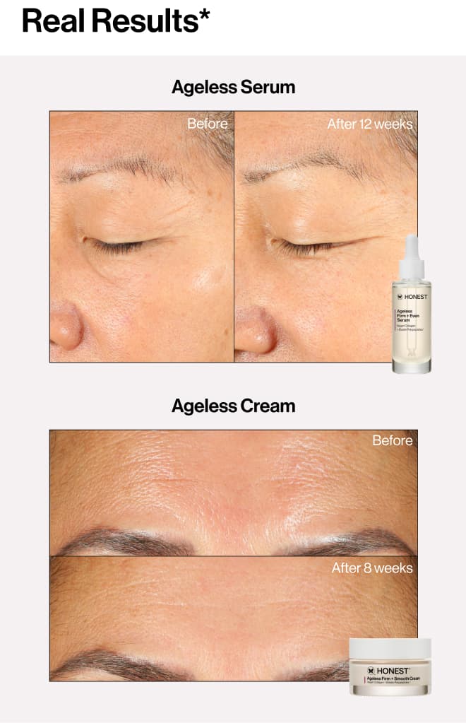 Real Results* before and after images of the Ageless Serum and Ageless Cream